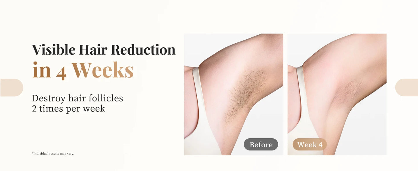 3-in-1 Laser Epilator Painless IPL Hair Removal for Women Bikini Legs Arms Laser Hair Remover 999900 Flash Permanent Depilato