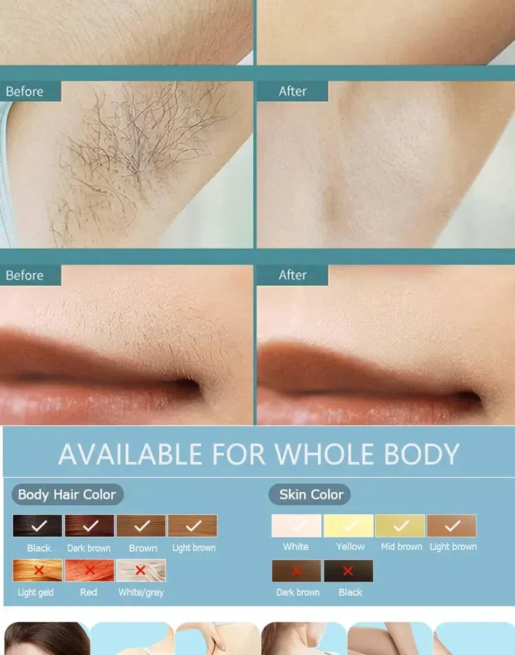 IPL Laser Hair Remover Intense Pulsed Light 500000 Pulses Permanent Laser Hair Remover Women's Painless Hair Removal Home Device